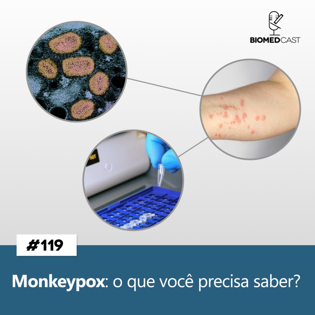 #119 Monkeypox: o que você precisa saber?