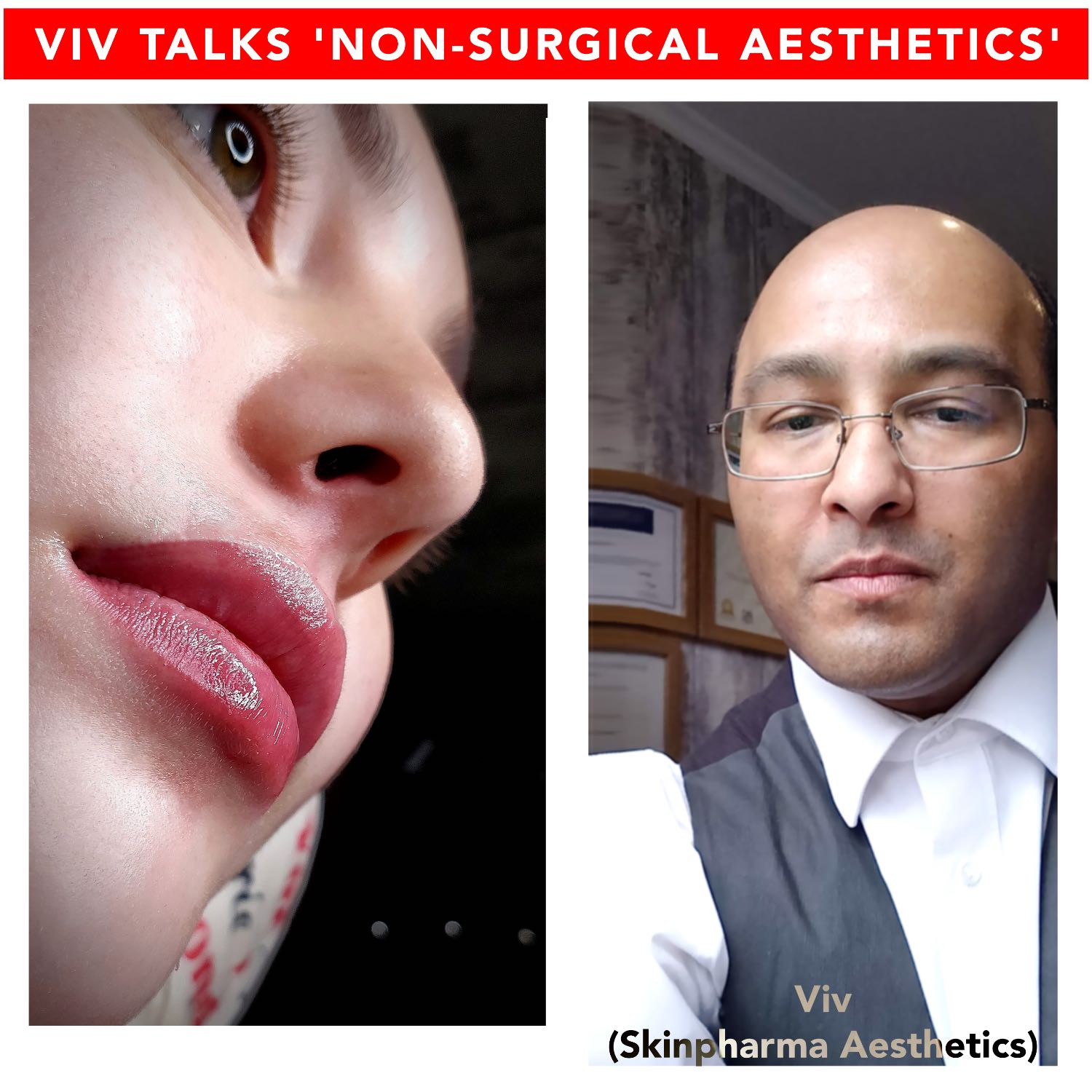 Vysana & Skinpharma Aesthetics: Part 27- Sunny & Viv talk to Dr Patricia Barrera about a case involving facial ultrasound scanning in a lip filler problem