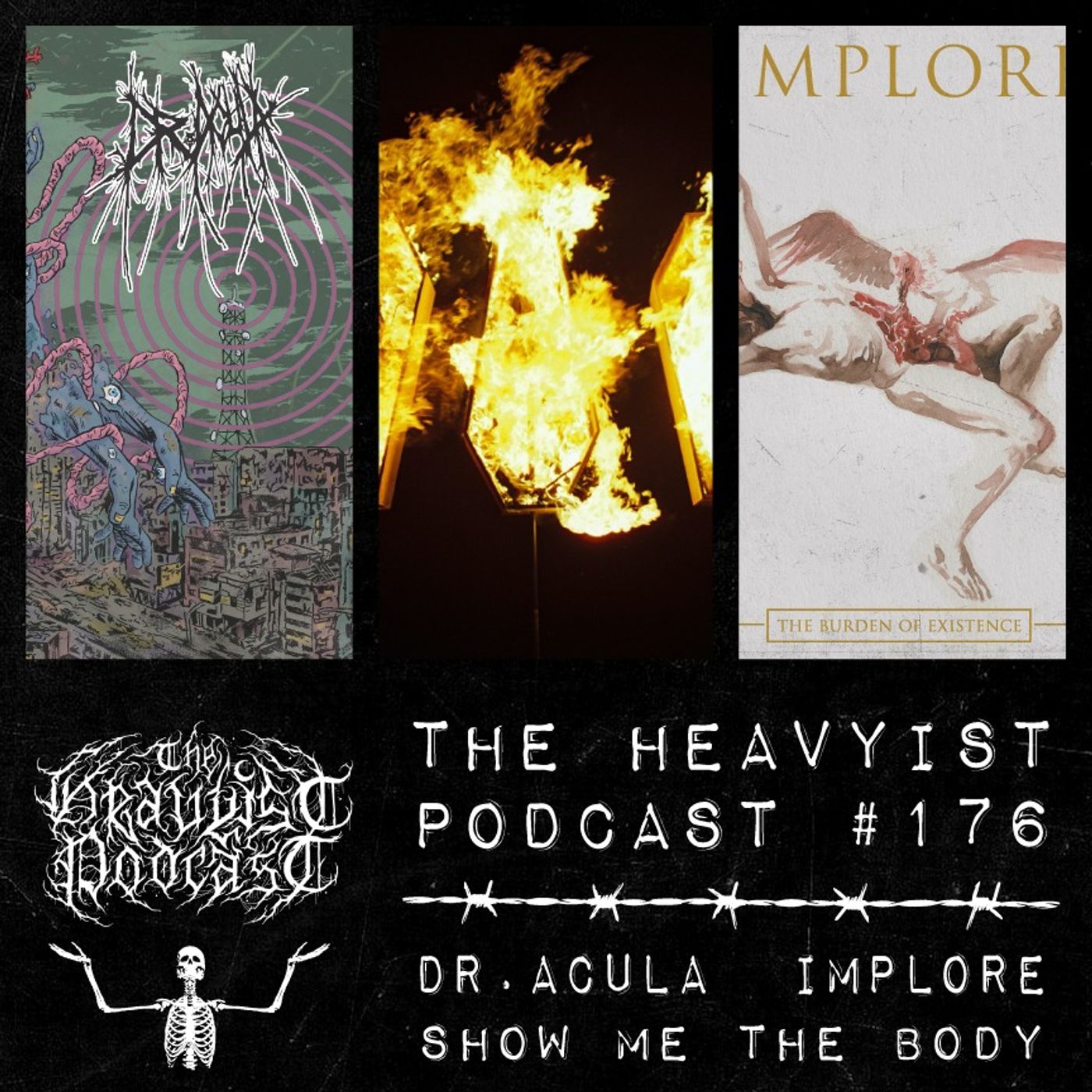 The Heavyist #176 Dr.Acula / Show Me the Body / Implore