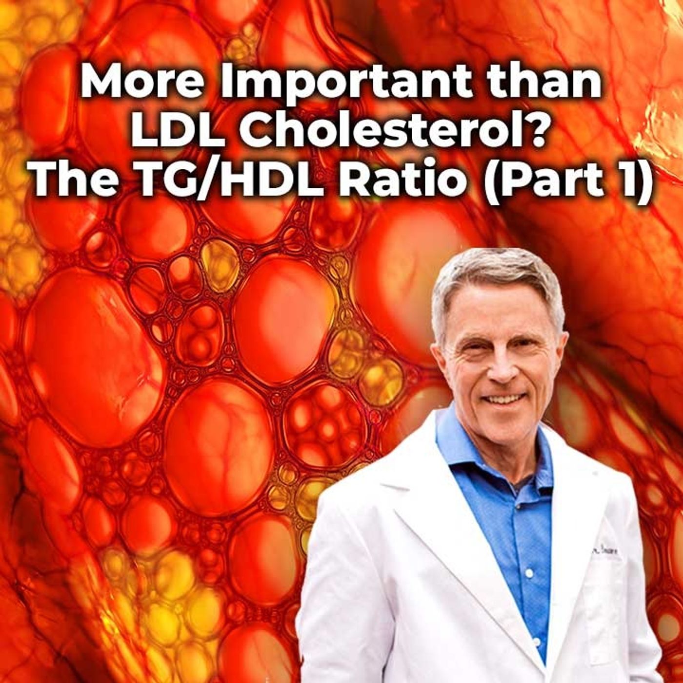 More Important than LDL Cholesterol? The TG/HDL Ratio (Part 1) - FORD BREWER MD MPH