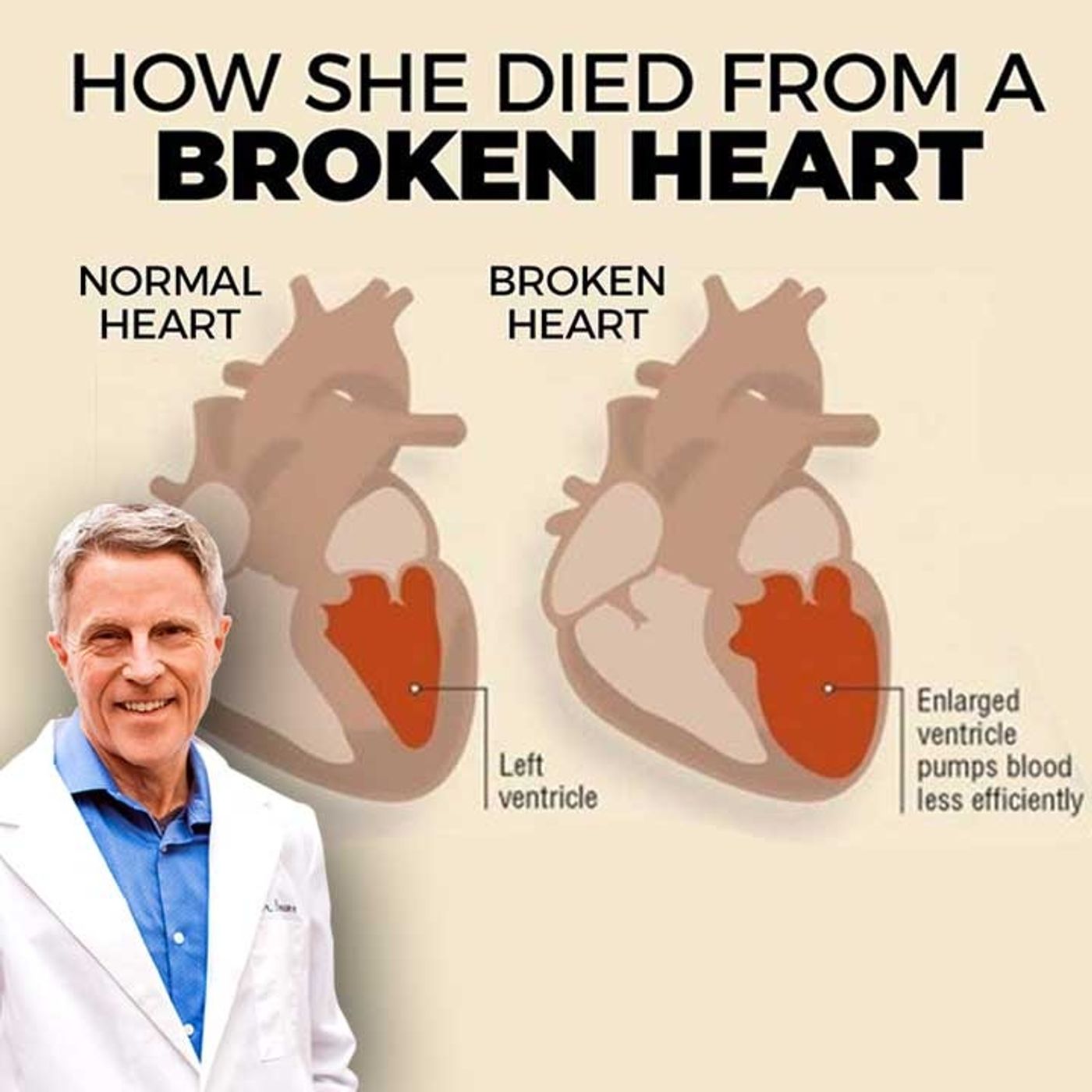 HOW SHE DIED FROM A BROKEN HEART - A True Story - FORD BREWER MD MPH