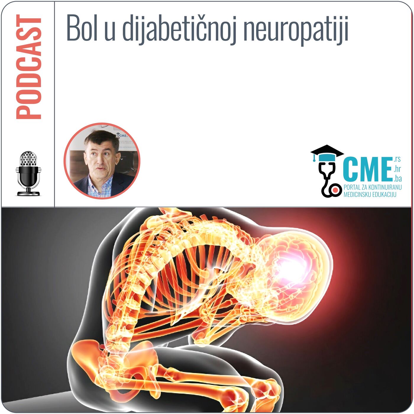 Bol u dijabetičnoj neuropatiji