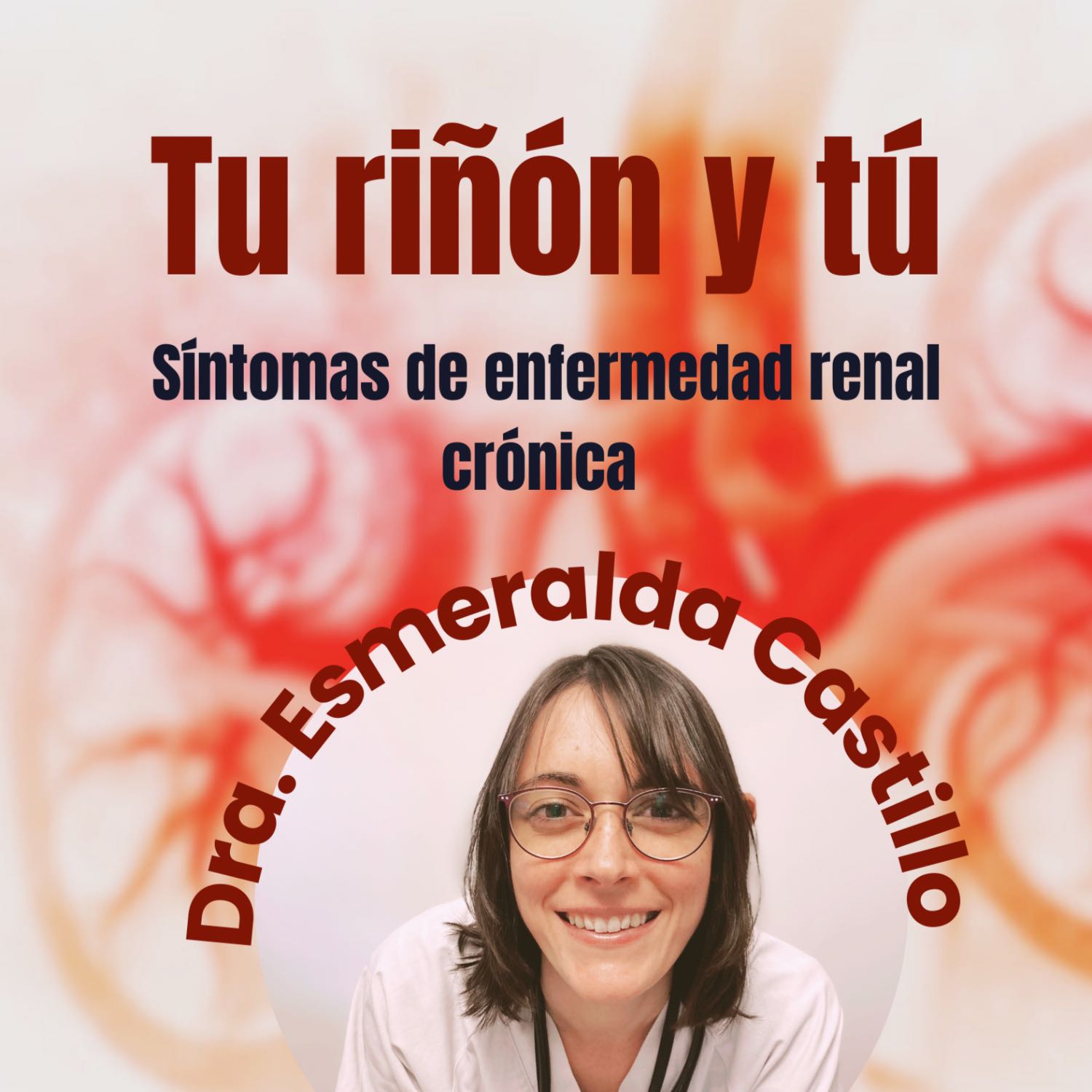 ¿Qué síntomas puedo notar si tengo una enfermedad renal crónica avanzada?