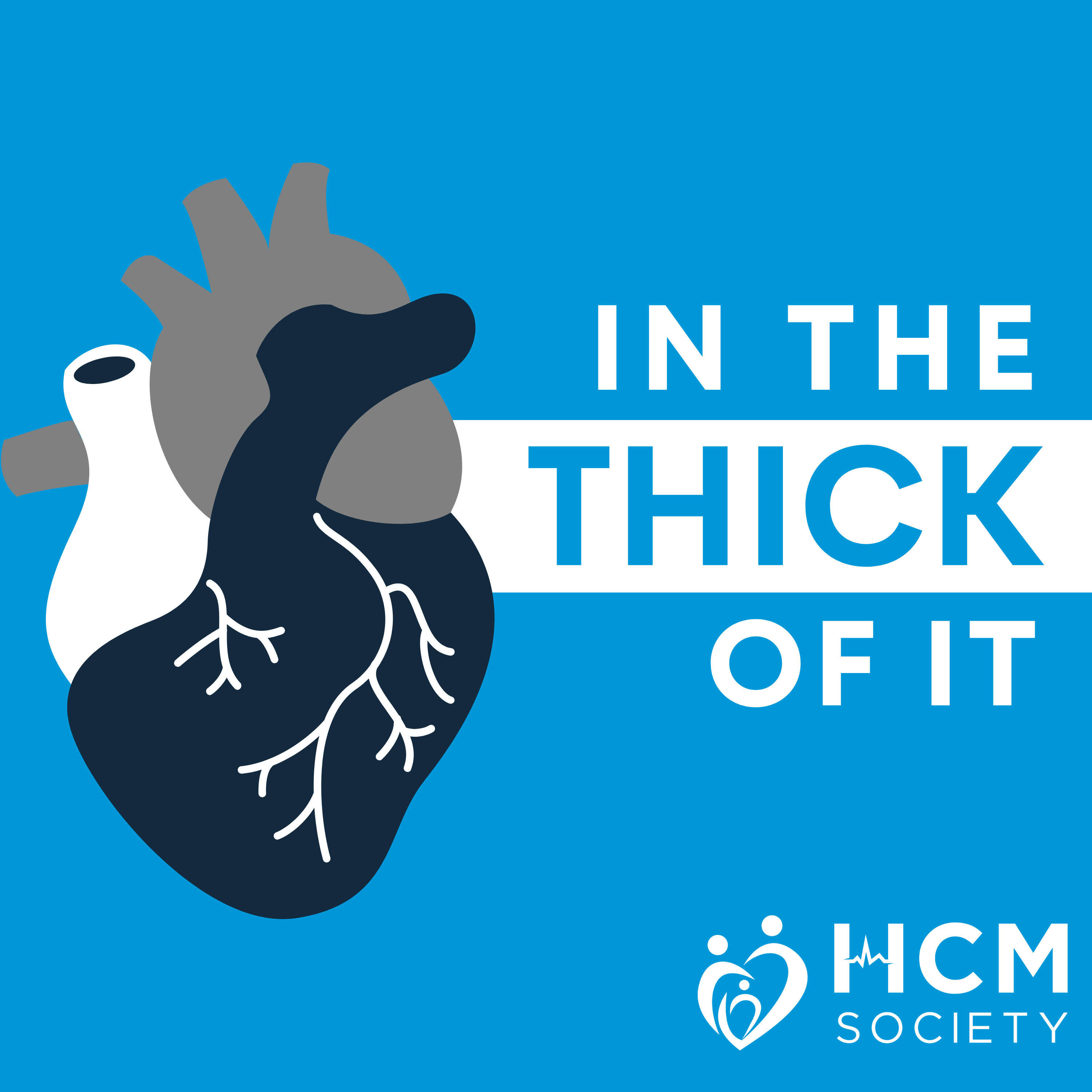 2. Obstructive Hypertrophic Cardiomyopathy: Survival in Patients 65 and Older