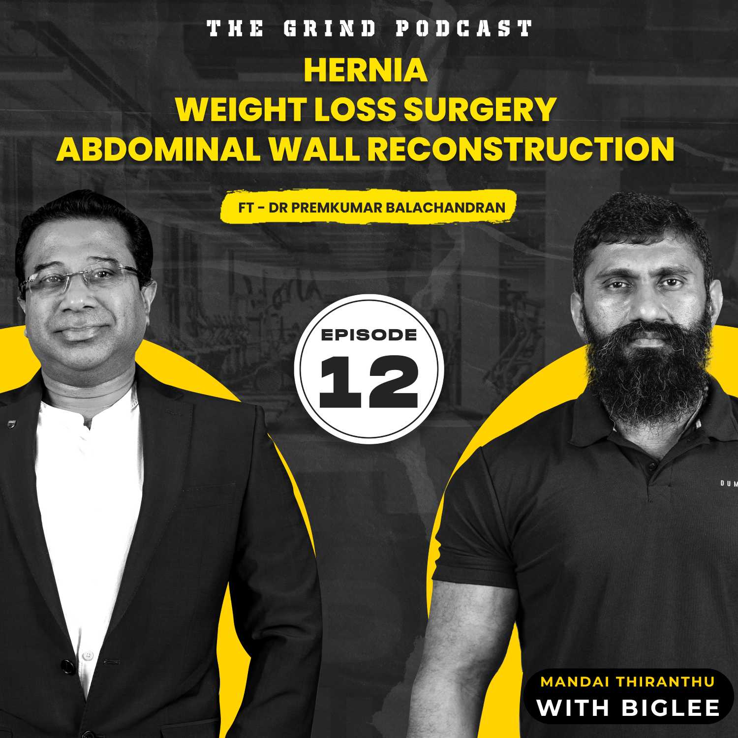 The grind podcast with BIglee - Ep12 - Hernia, weight loss surgery, abdominal wall reconstruction - mandai thirandhu ft Dr Premkumar Balachandran