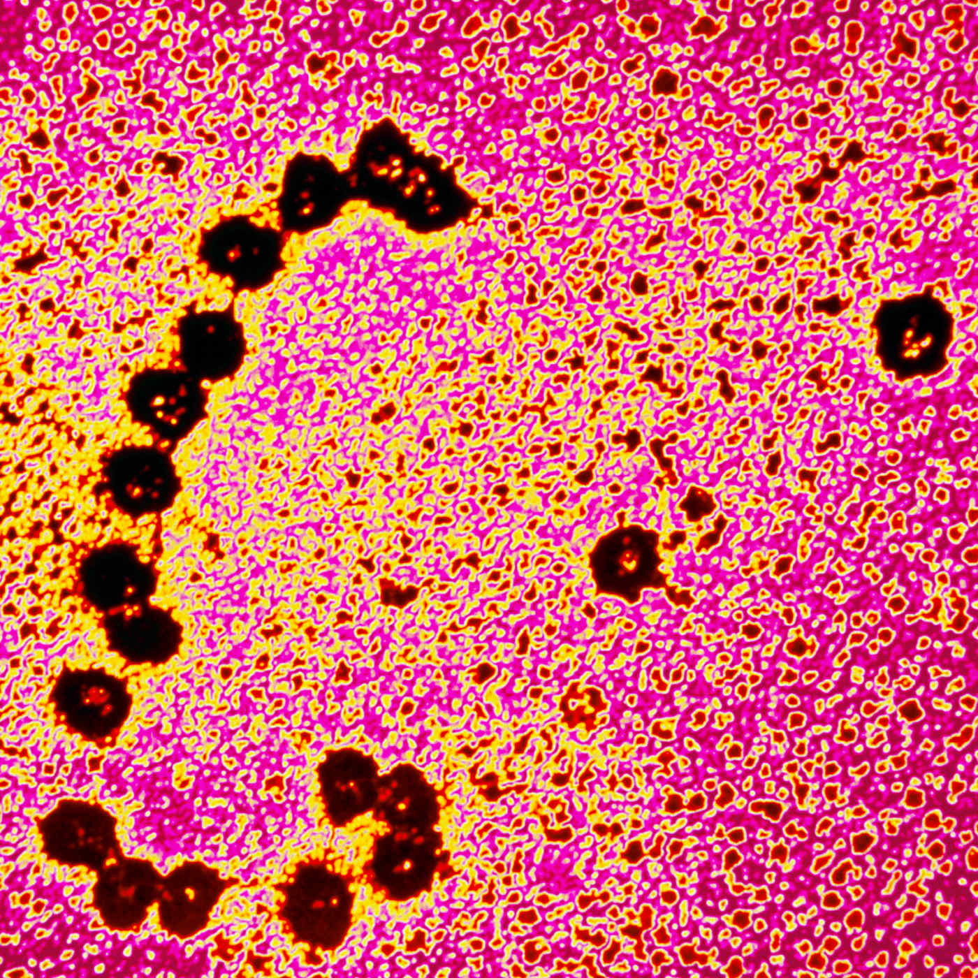 ⁣Die Idee einer mRNA-Impfung stammt aus der Krebsforschung