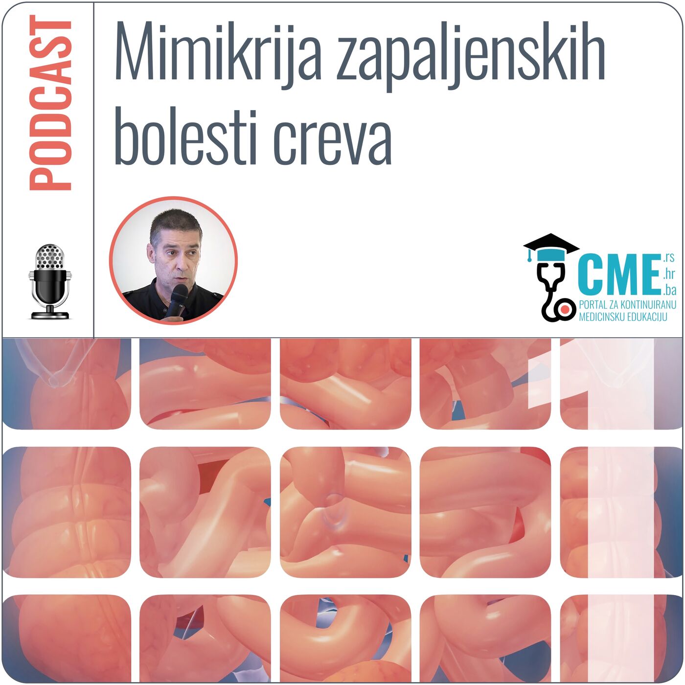 ⁣Mimikrija zapaljenskih bolesti creva