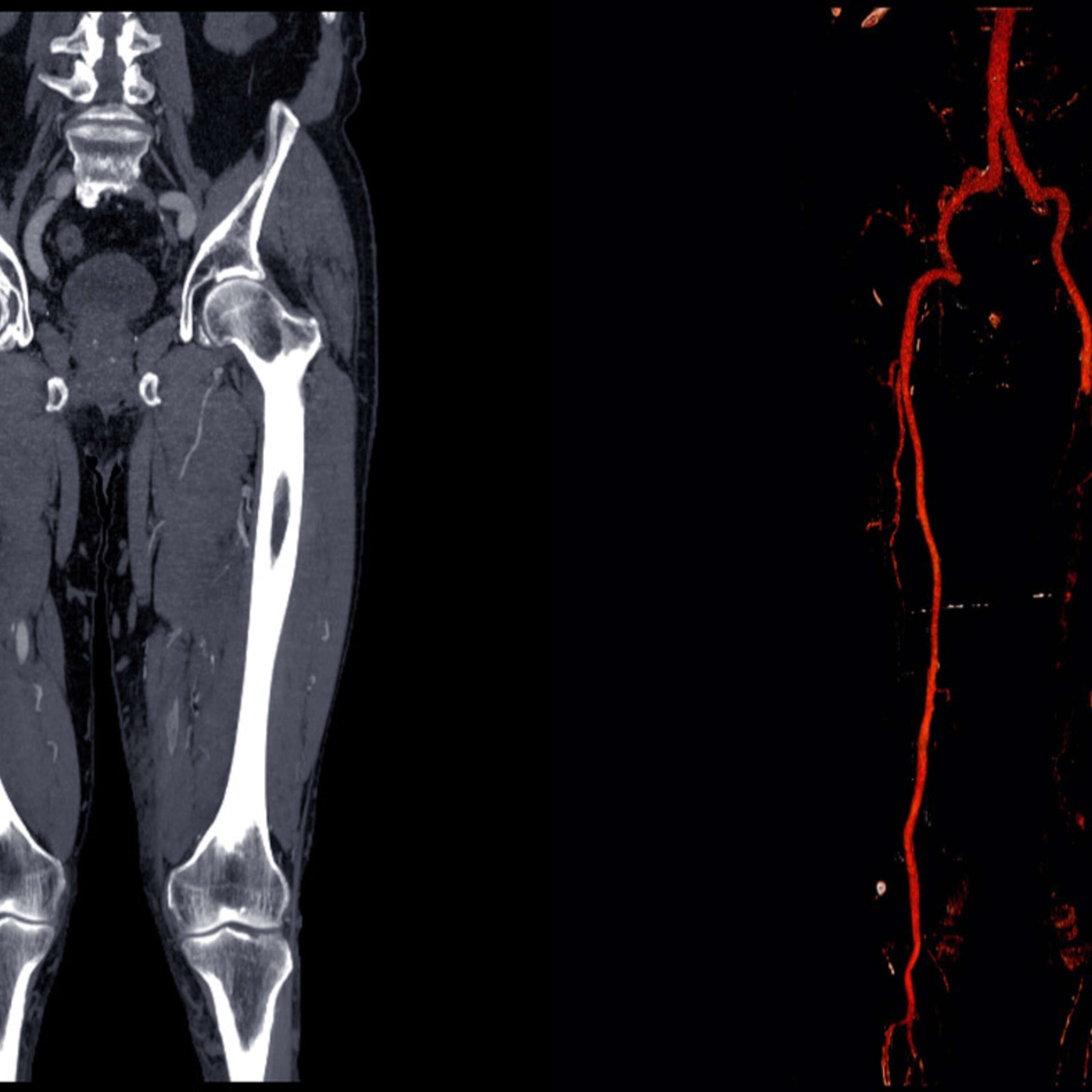 ⁣73. Understanding Lower Extremity Pain with Pradeep Chopra, MD