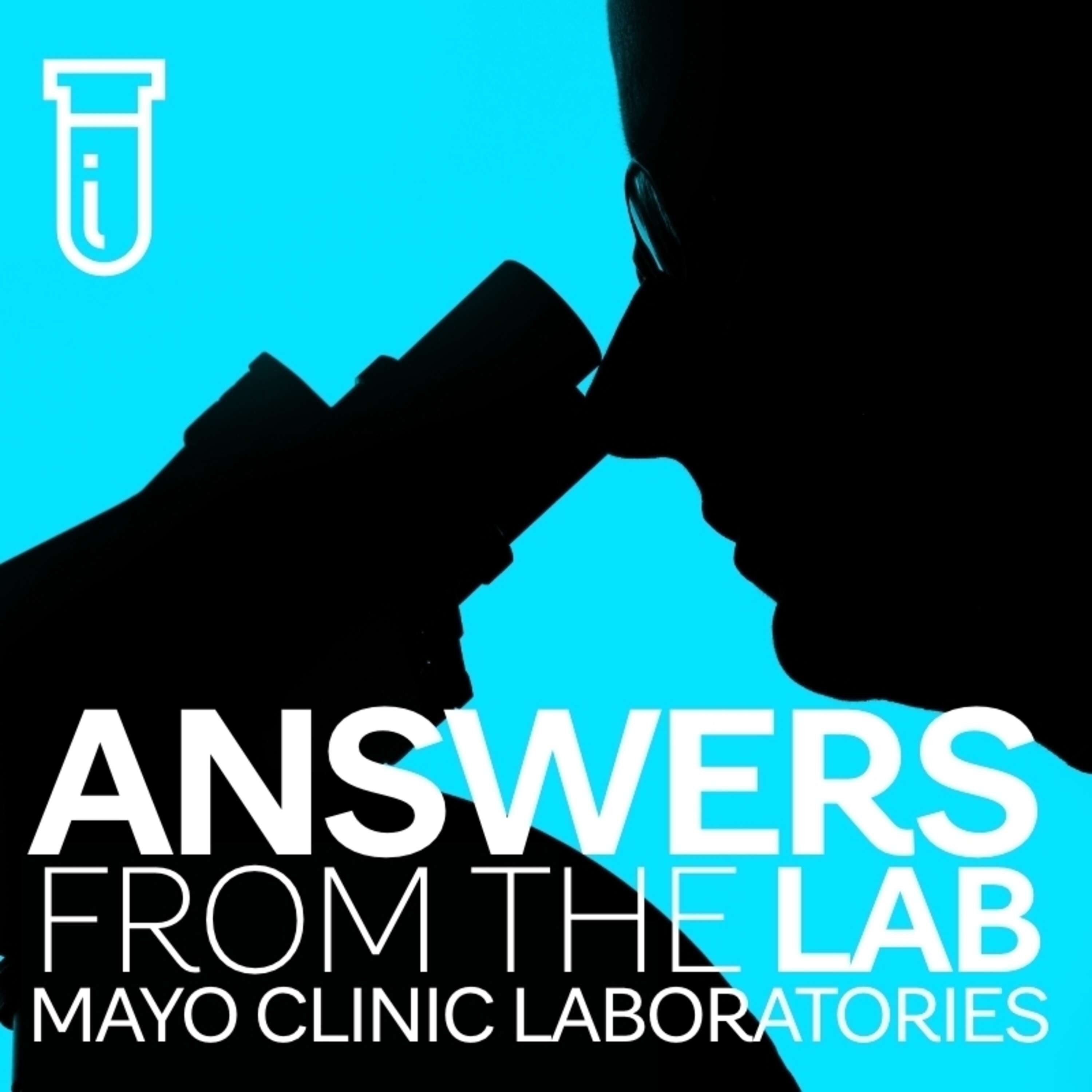 ⁣Test for LDL subtype helps manage coronary risk: Vlad Vasile, M.D., Ph.D., and Leslie Donato, Ph.D.