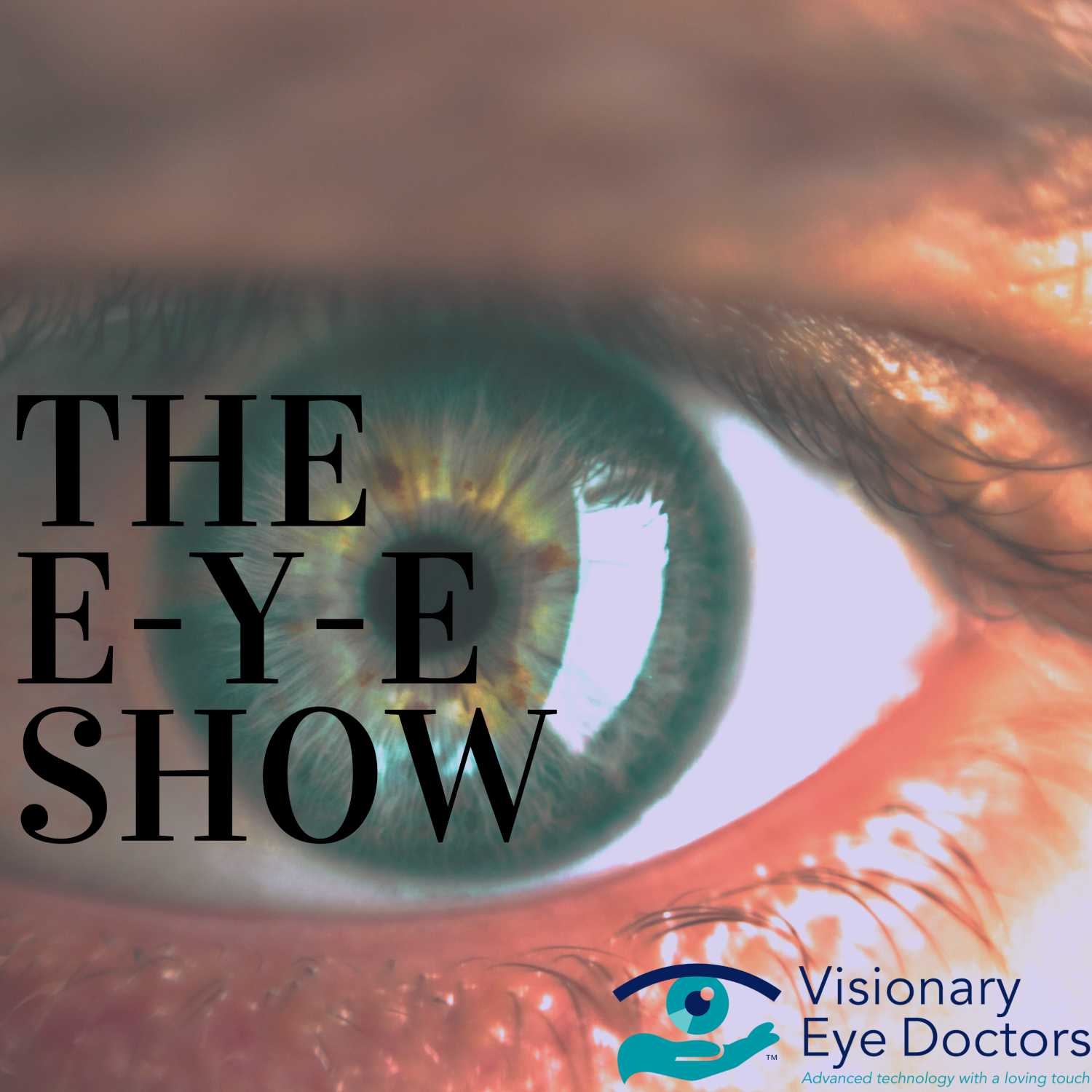 The Eye Show 