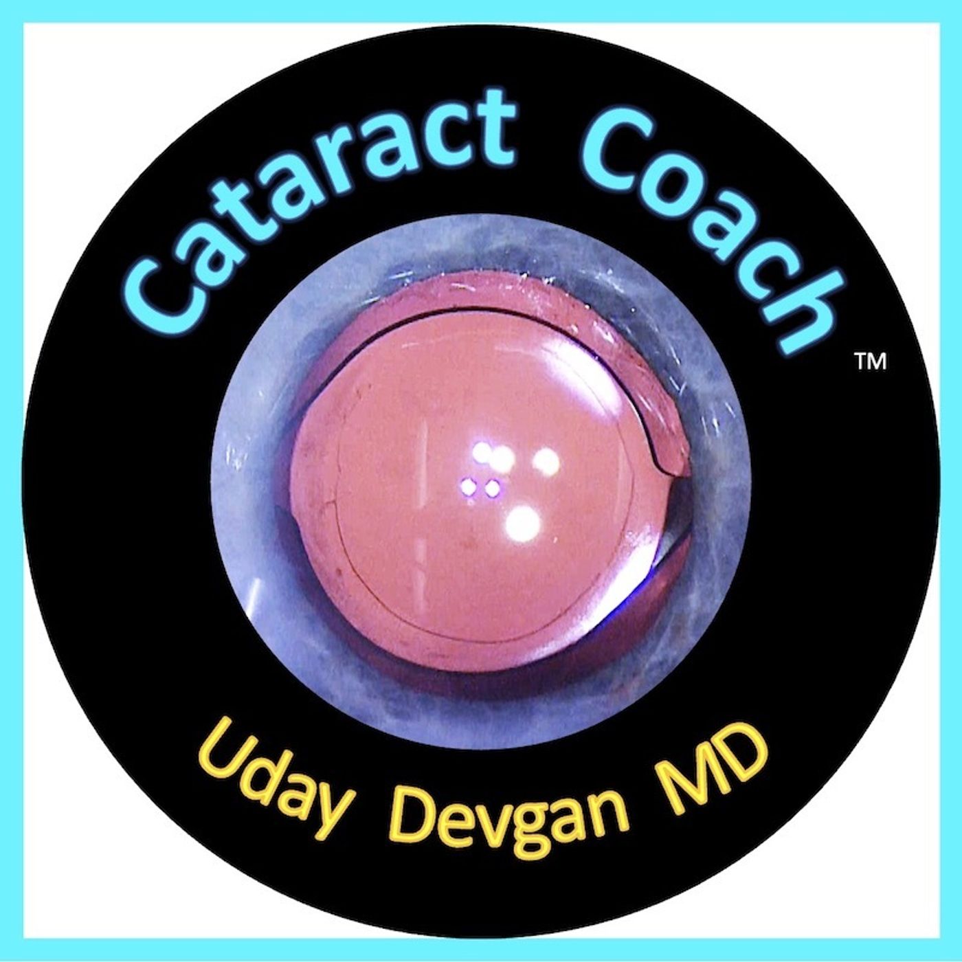 Cataract Coach with Uday Devgan MD 