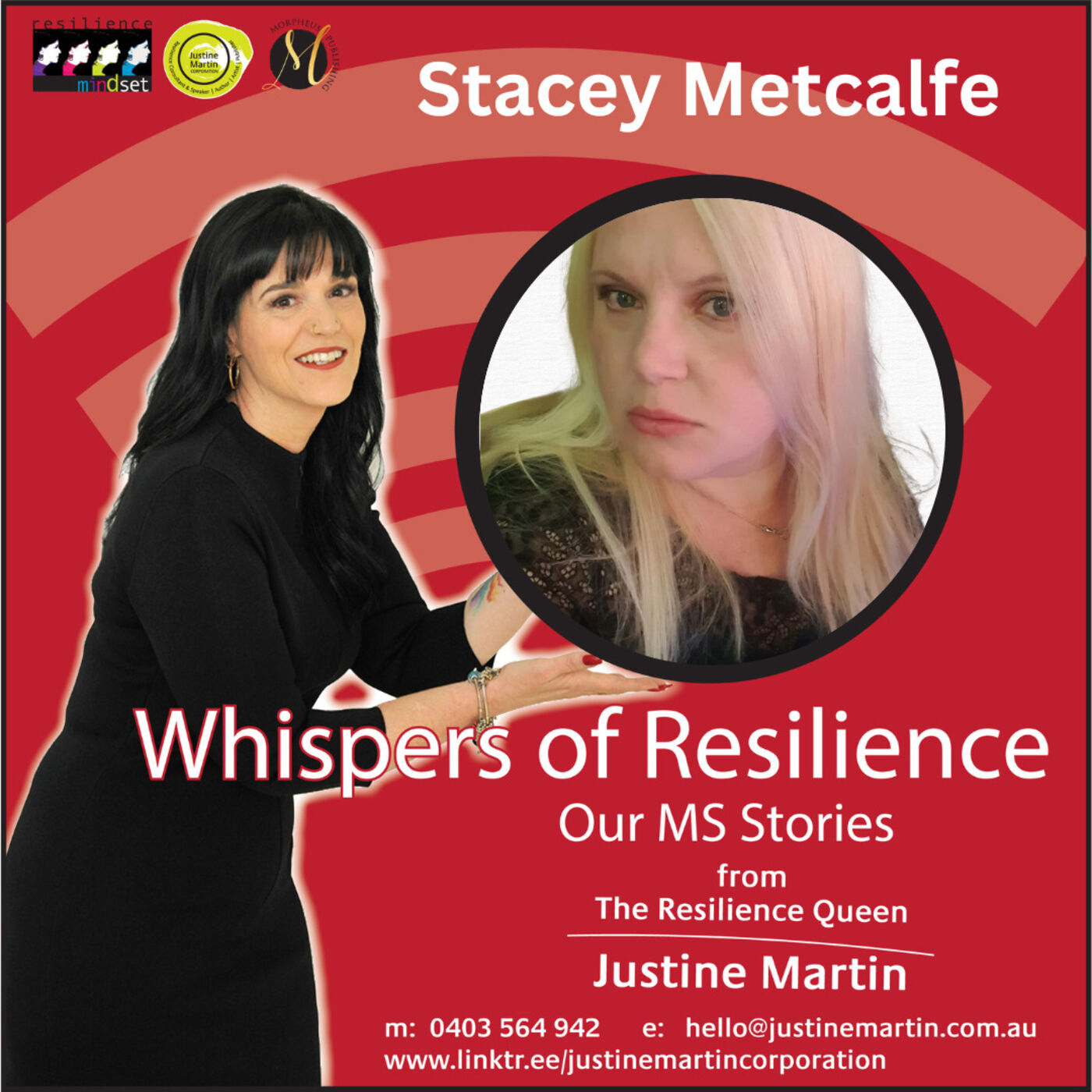 Whispers of Resilience Our MS Stories Podcast S3 EP 18 - Stacey Metcalfe