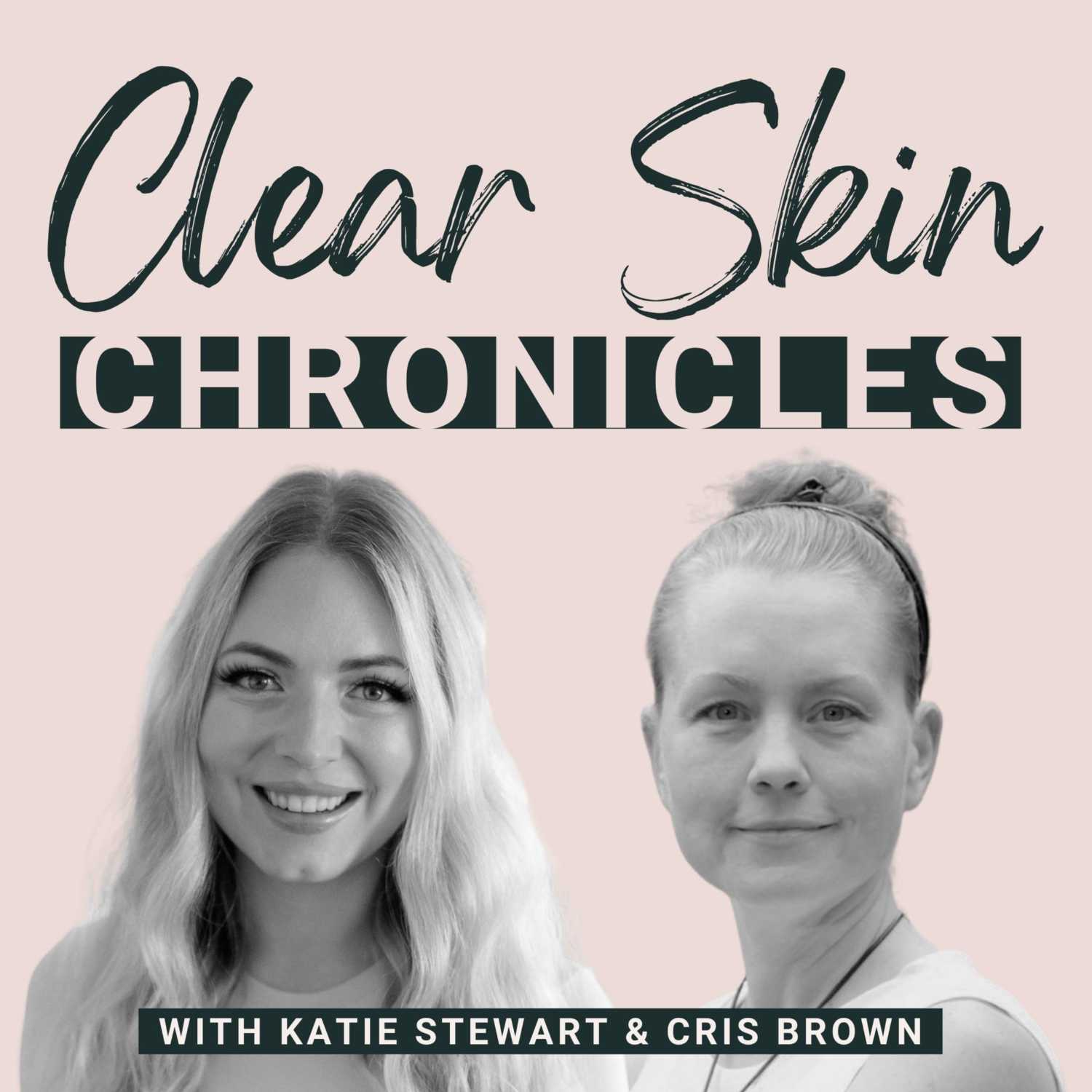 ⁣Can Endometriosis Cause Acne?