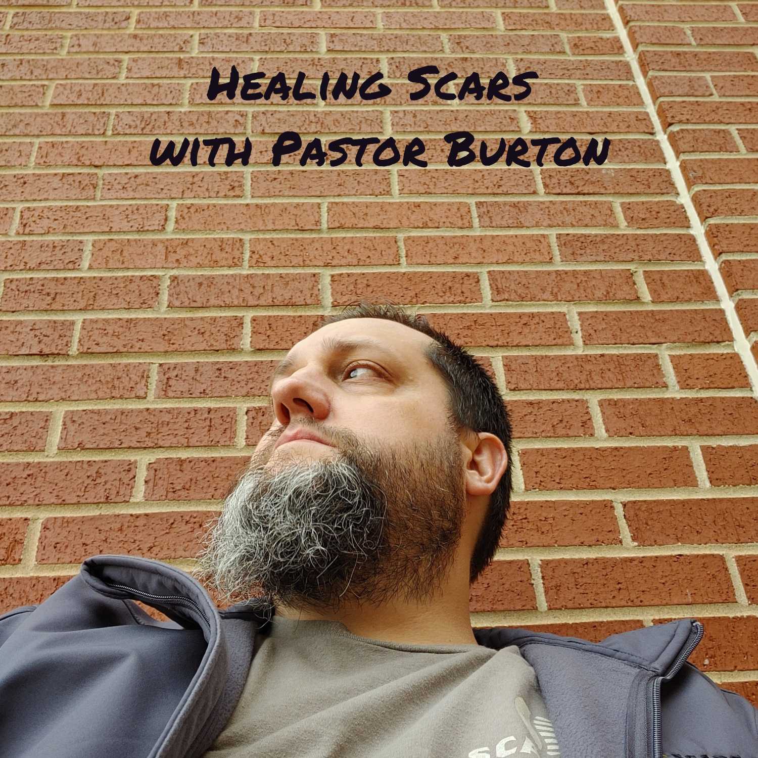 Healing Scars with Pastor Burton 