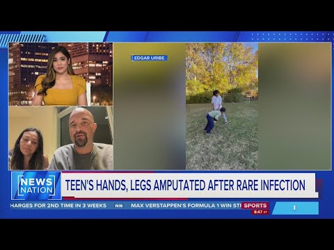 Teen's hands, legs amputated after rare infection | NewsNation Prime